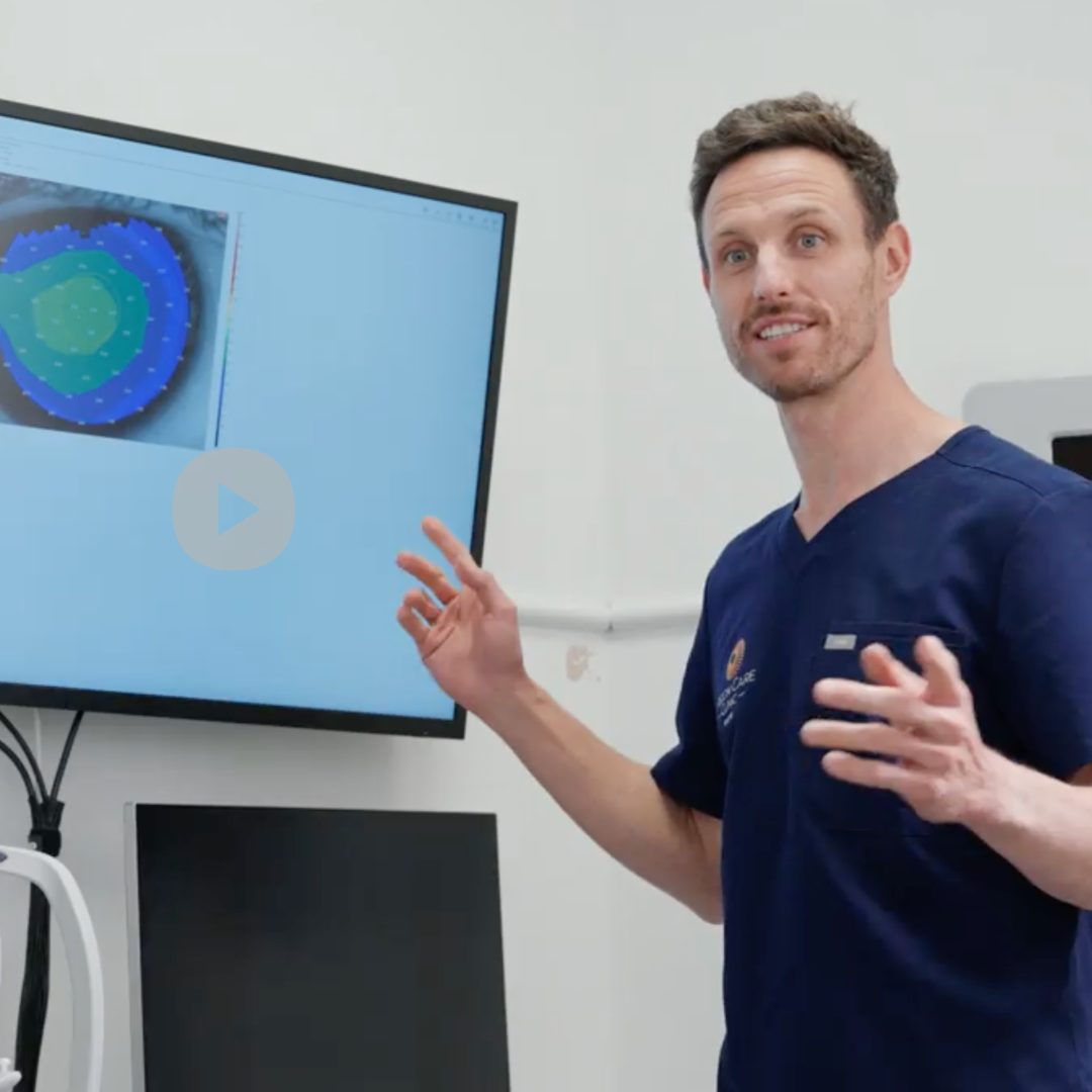 Kieren Darcy | Cataract Surgeon Bristol